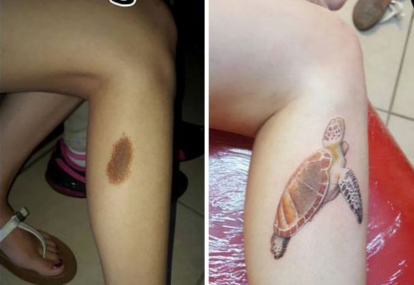 Creative Birthmark Cover Up Tattoos
