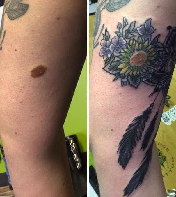 Creative Birthmark Cover Up Tattoo