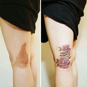 birthmarks tattoo on leg